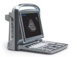 CHISON ECO2